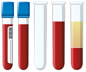 Wall Mural - Set of blood collection tubes