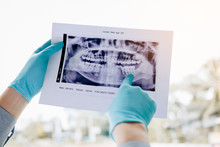 Asian Male Dentists Are Analyzing X-ray Images Of Patients And Pointing Problem At The Lab.