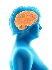 Wall Mural - 3d rendered medically accurate illustration of an obese womans brain