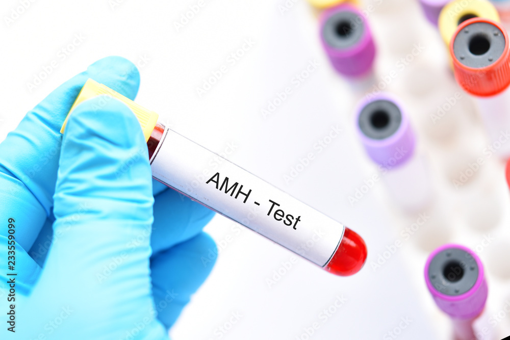 Blood sample tube for anti-Müllerian hormone or AMH test Stock Photo ...