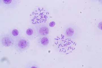 Poster - Chromosomes Human under the microscope for education in Lab.