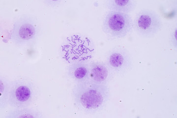 Wall Mural - Chromosomes Human under the microscope for education in Lab.