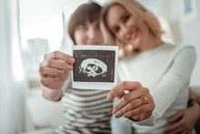 Future Mothers. Two Joyful Ladies Carrying Black And White Picture Of Embryo On Early Stage Of Pregnancy