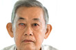 Acute angle glaucoma on right eye and normal eye on left of old asian man.