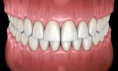 healthy human teeth with normal occlusion frontal view. medically accurate tooth 3d illustration