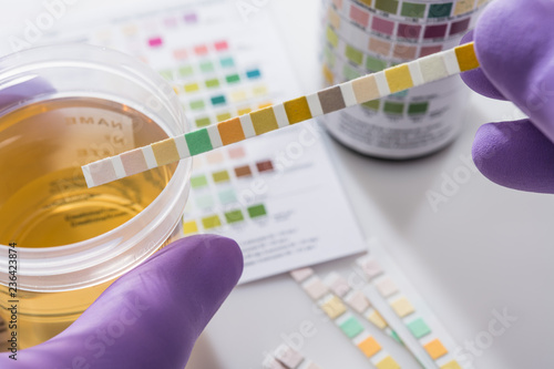 Fotomural urine test strips in purple gloves