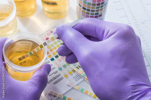 Cuadros en Lienzo urine test strips in purple gloves