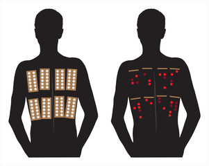 allergy patch skin tests vector illustration