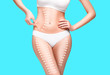 © master1305 - Female body with the drawing arrows on it. Fat lose, liposuction and cellulite removal concept.