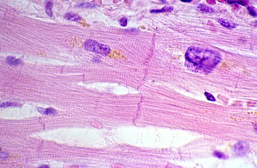 Wall Mural - Cardiac myocytes. Lipofuscin