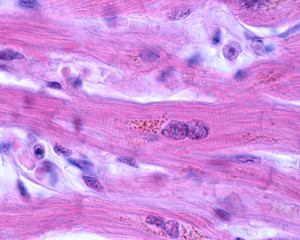 Wall Mural - Cardiac myocytes. Lipofuscin