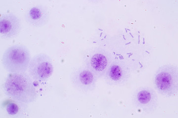 Poster - Chromosomes Human under the microscope for education.