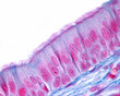 Ciliated pseudostratified columnar epithelium