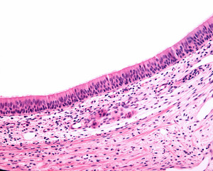 Poster - Trachea. Mucosa