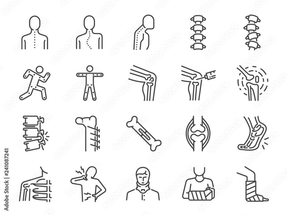 Orthopedics line icon set. Included the icons as osteoarthritis ...