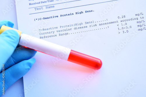 Normal Result Of C Reactive Protein Or Crp Test With Blood Sample