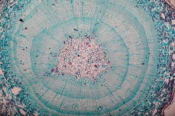 Wall Mural - Cross-section Dicot, Monocot and Root of Plant Stem under the microscope for classroom education. 