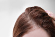 © Pixel-Shot - Woman with hair loss problem on white background, closeup