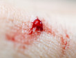 © donikz - Blood on the skin from a cut with a knife