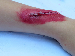 Heavy wound on a human hand. Bloody wound makeup special effect