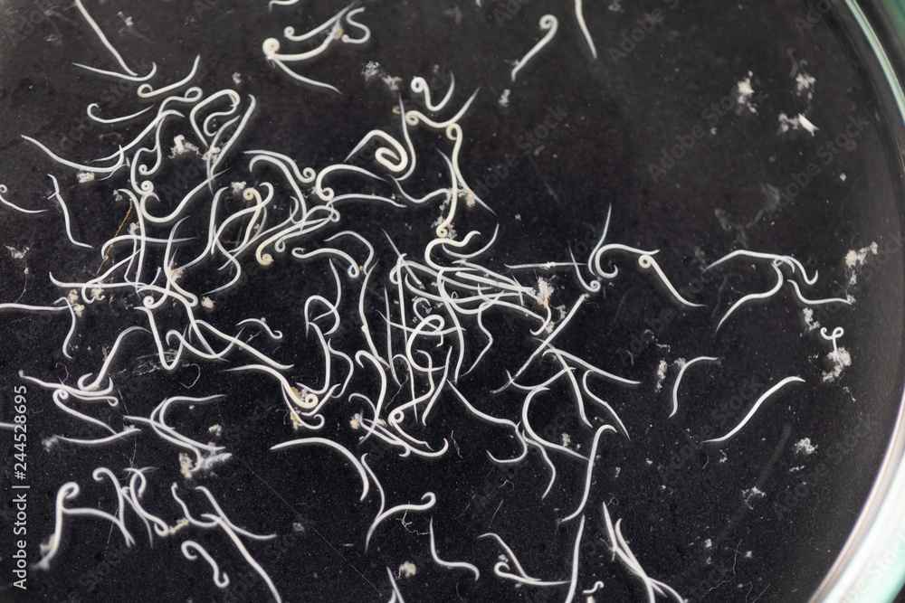 Ascariasis is a disease caused by the parasitic roundworm Ascaris ...
