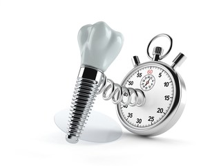 Poster - Dental implant with stopwatch