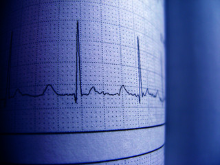 Wall Mural - Sinus Heart Rhythm On Electrocardiogram Record Paper Showing Normal P Wave, PR and QT Interval and QRS Complex, EKG paper