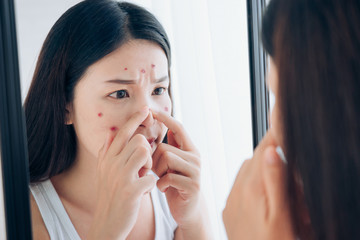 Wall Mural - Young Asian woman squeeze acne problem face looking at mirror her without Skincare.