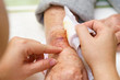 © BBbirdZ - Close up old woman hand, upper limb or arm to the wounded waiting for nurse treatment on wound dressing a bloody and brine of patient.
