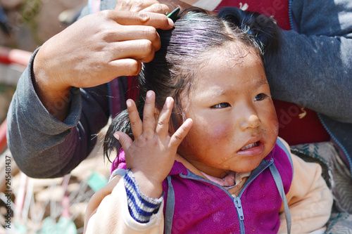 Little Native American Kid Feeling Pain Because Of Brushing Her