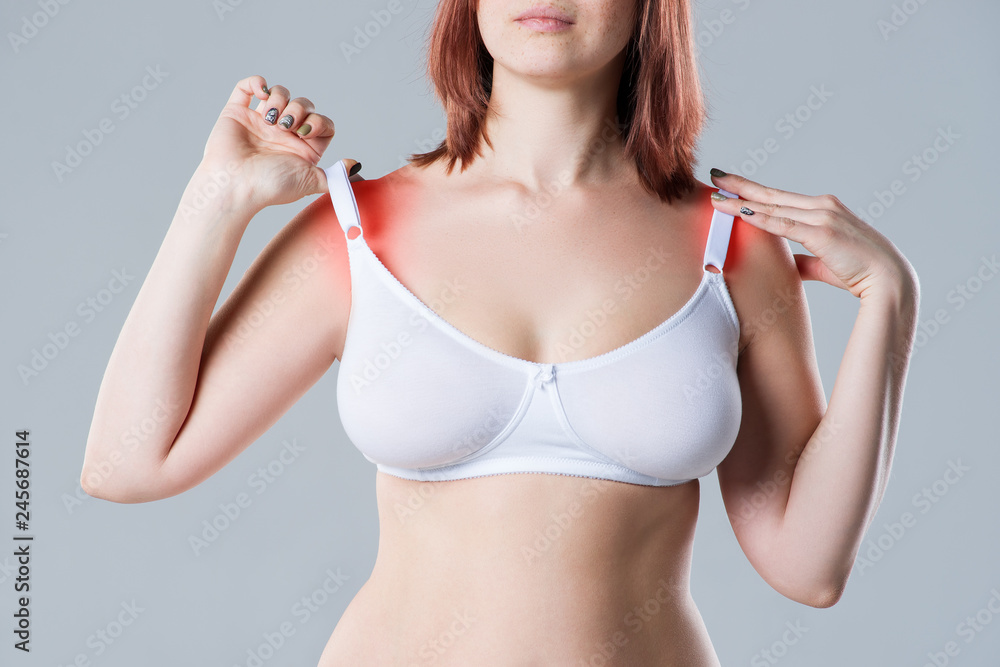 Woman with irritated skin under bra, irritation on the body from underwear on gray background - obrazy, fototapety, plakaty 