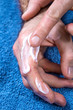 Sucha skóra dłoni. Smarowanie rąk kremem nawilżającym. Mężczyzna wsmarowuje krem nawilżający w skórę dłoni.  