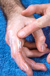 Sucha skóra dłoni. Smarowanie rąk kremem nawilżającym. Mężczyzna wsmarowuje krem nawilżający w skórę dłoni.   Męska dłoń na niebieskim frotowym ręczniku posmarowana białą maścią. 