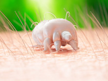 Illustration Of A Scabies Mite On Human Skin