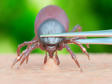 Illustration Of A Tick Being Removed