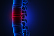 Human spinal pain concept. Disk spain degradation. X-ray illustration. 3d rendering.