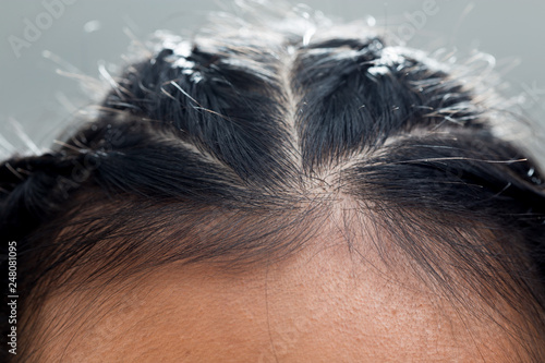 Closeup Macro Portrait Of Female Hair Head Part Human Woman Open