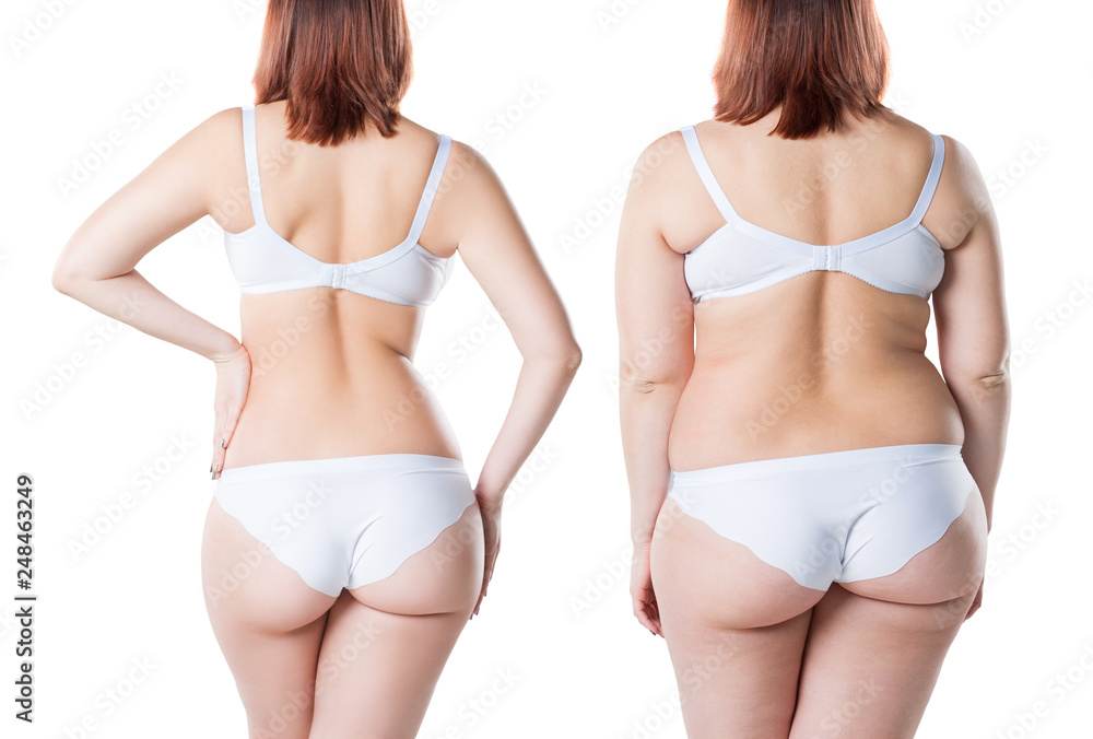 Woman's body before and after weight loss isolated on white background, plastic surgery concept - obrazy, fototapety, plakaty 