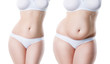 © staras - Woman's body before and after weight loss isolated on white background, plastic surgery concept