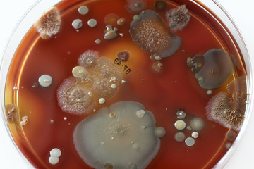 Poster - Petri dish with colonies of bacteria