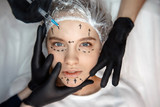 Fototapeta  - Calm peaceful young woman lying on couch and look straight forward. Her face is marked. Three hands touching face skin. Fourth hold syringe for injection.