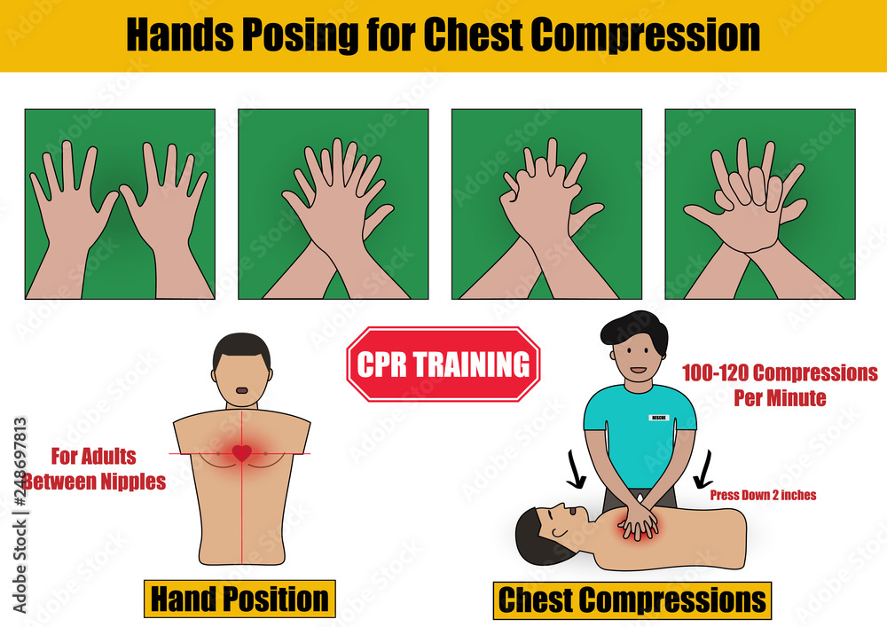 Hands Posing for Chest Compressions Step in CPR Emergency Rescue ...