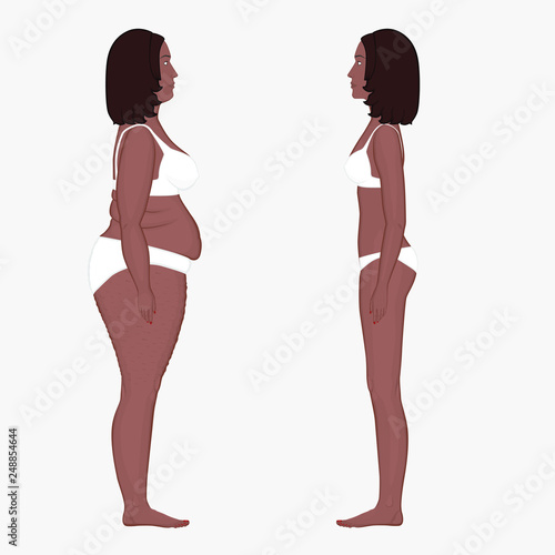 Vector Illustration Body Weight Loss In An African American Vector Illustration Body Weight Loss In An African American