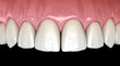 © Alex Mit - Maxillary human gum and teeth. Medically accurate tooth 3D illustration
