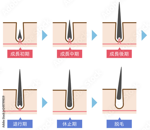 脱毛の毛周期シンプルかわいい説明図イラスト Buy This Stock Illustration And Explore Similar Illustrations At Adobe Stock Adobe Stock