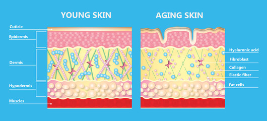 The diagram of younger skin and aging skin