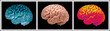 THREE PICTURE SEQUENCE OF HUMAN BRAIN