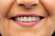 © Syda Productions - dental care and hygiene people concept - close up of senior woman smiling mouth and teeth