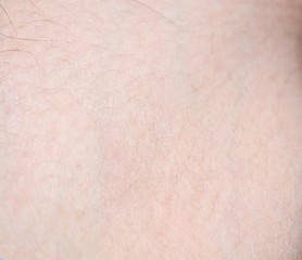 the texture of the human skin
