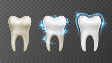 Vector Illustration Of Teeth Whitening Process - Cleaning And Protection From Stains And Bacteria